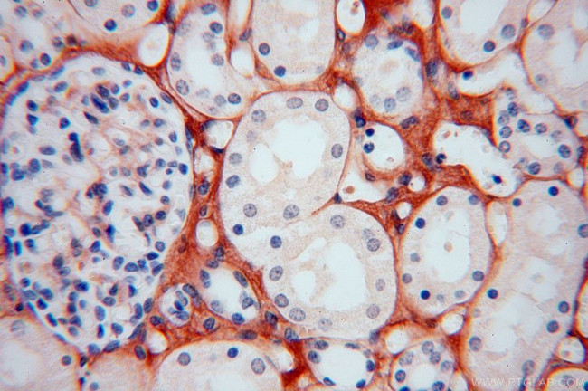 Collagen Type VI Antibody in Immunohistochemistry (Paraffin) (IHC (P))