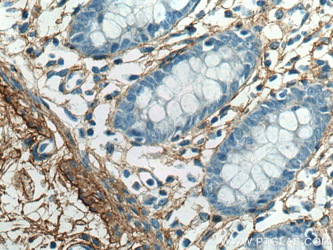 Collagen Type VI Antibody in Immunohistochemistry (Paraffin) (IHC (P))