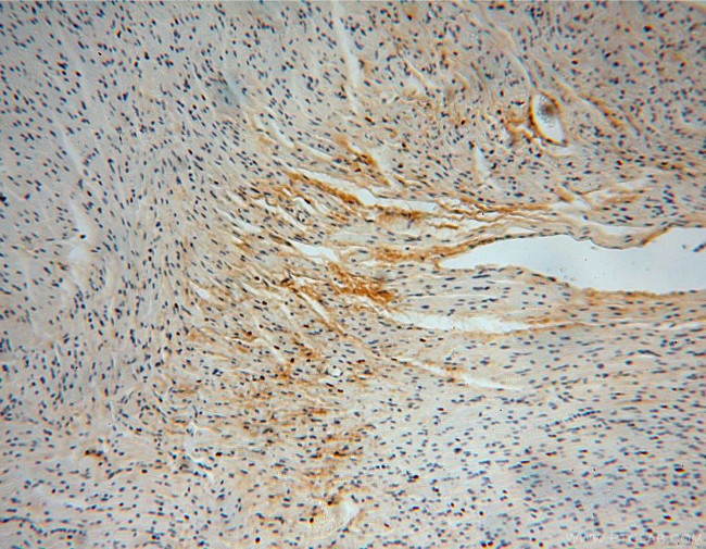 Collagen Type VI Antibody in Immunohistochemistry (Paraffin) (IHC (P))