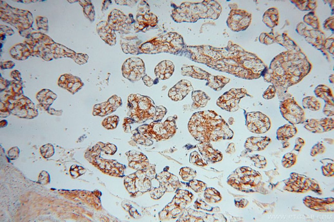 Collagen Type VI Antibody in Immunohistochemistry (Paraffin) (IHC (P))