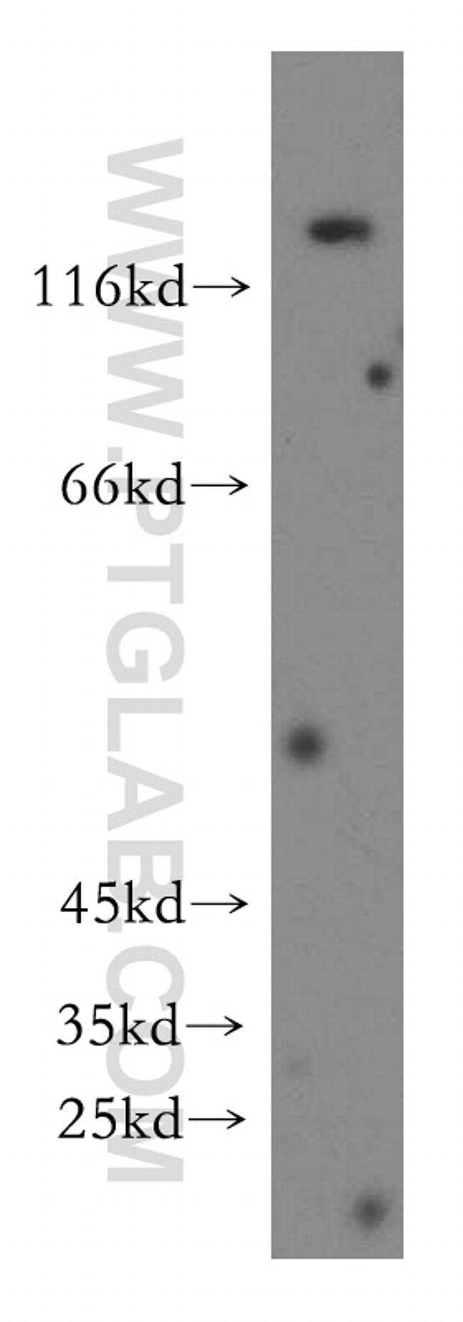 Collagen Type VI Antibody in Western Blot (WB)