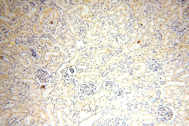 GPR132 Antibody in Immunohistochemistry (Paraffin) (IHC (P))