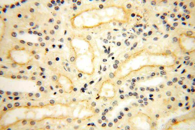 GPR132 Antibody in Immunohistochemistry (Paraffin) (IHC (P))