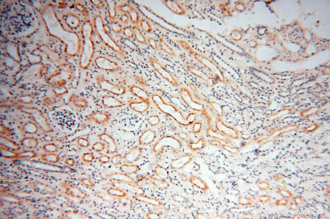 GPR132 Antibody in Immunohistochemistry (Paraffin) (IHC (P))