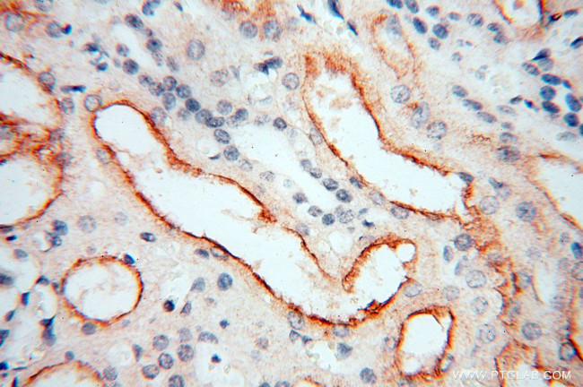 GPR132 Antibody in Immunohistochemistry (Paraffin) (IHC (P))