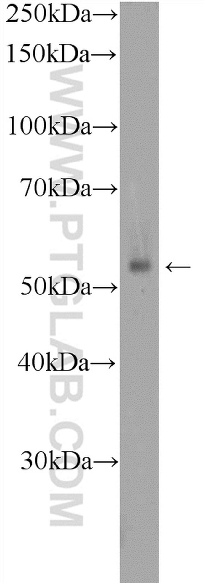 GPR132 Antibody in Western Blot (WB)