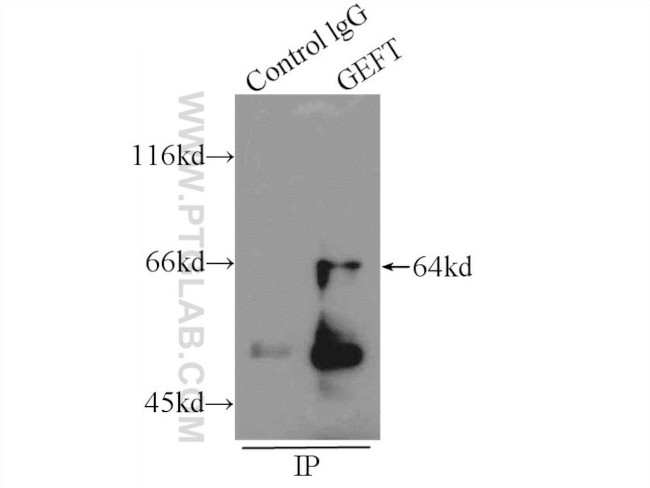 GEFT Antibody in Immunoprecipitation (IP)