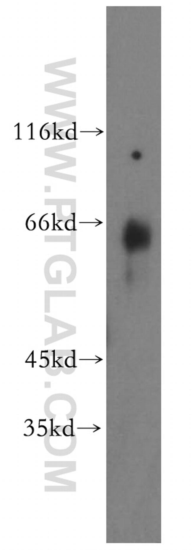 GEFT Antibody in Western Blot (WB)