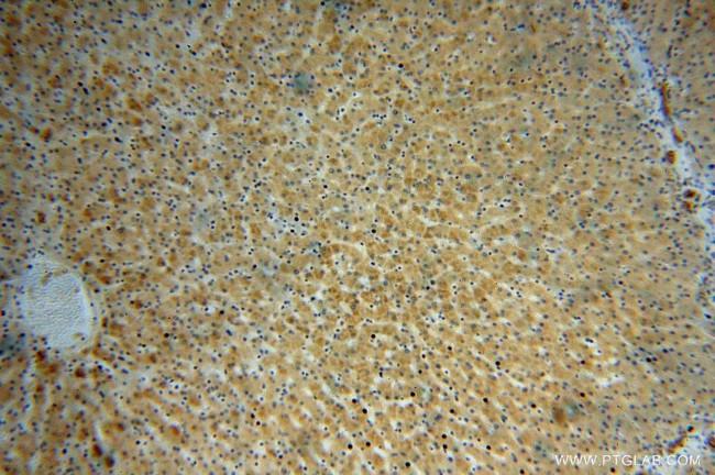 MUT Antibody in Immunohistochemistry (Paraffin) (IHC (P))