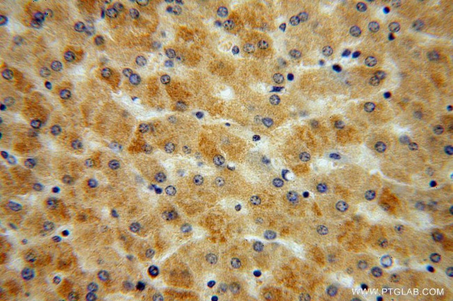 MUT Antibody in Immunohistochemistry (Paraffin) (IHC (P))