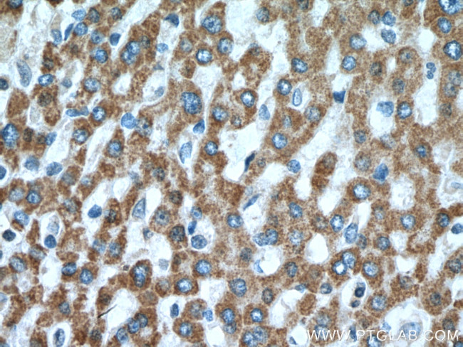 MUT Antibody in Immunohistochemistry (Paraffin) (IHC (P))