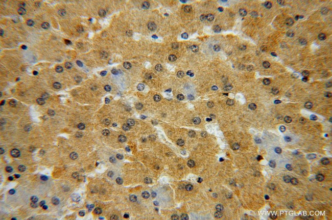 GALT Antibody in Immunohistochemistry (Paraffin) (IHC (P))