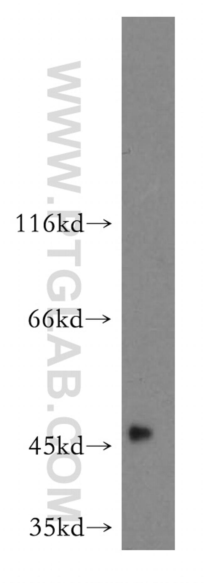 GALT Antibody in Western Blot (WB)