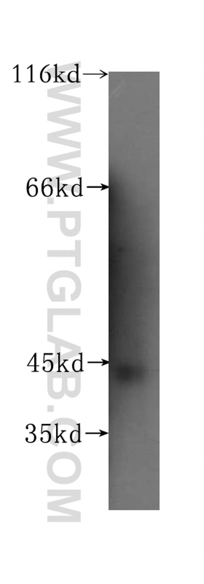 GALT Antibody in Western Blot (WB)