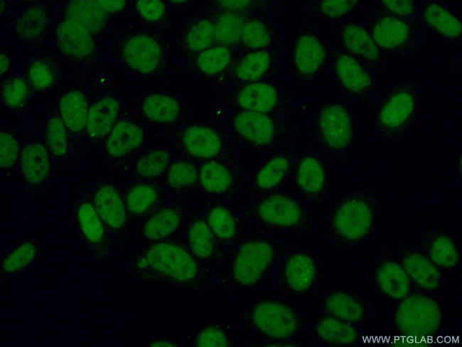 CHAF1A Antibody in Immunocytochemistry (ICC/IF)