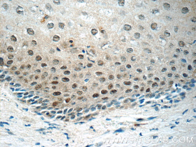 CHAF1A Antibody in Immunohistochemistry (Paraffin) (IHC (P))