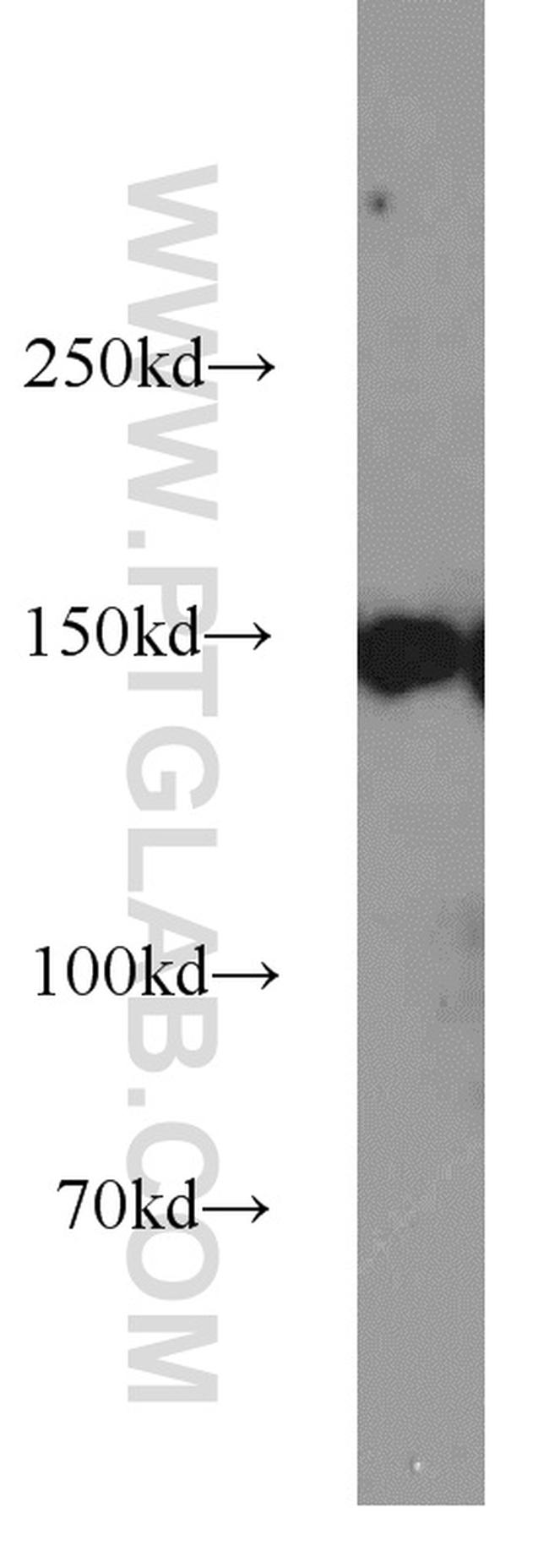 CHAF1A Antibody in Western Blot (WB)