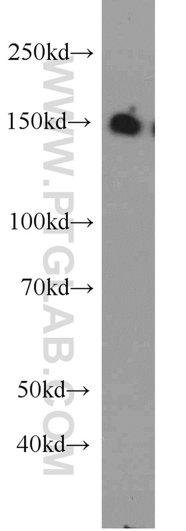 CHAF1A Antibody in Western Blot (WB)