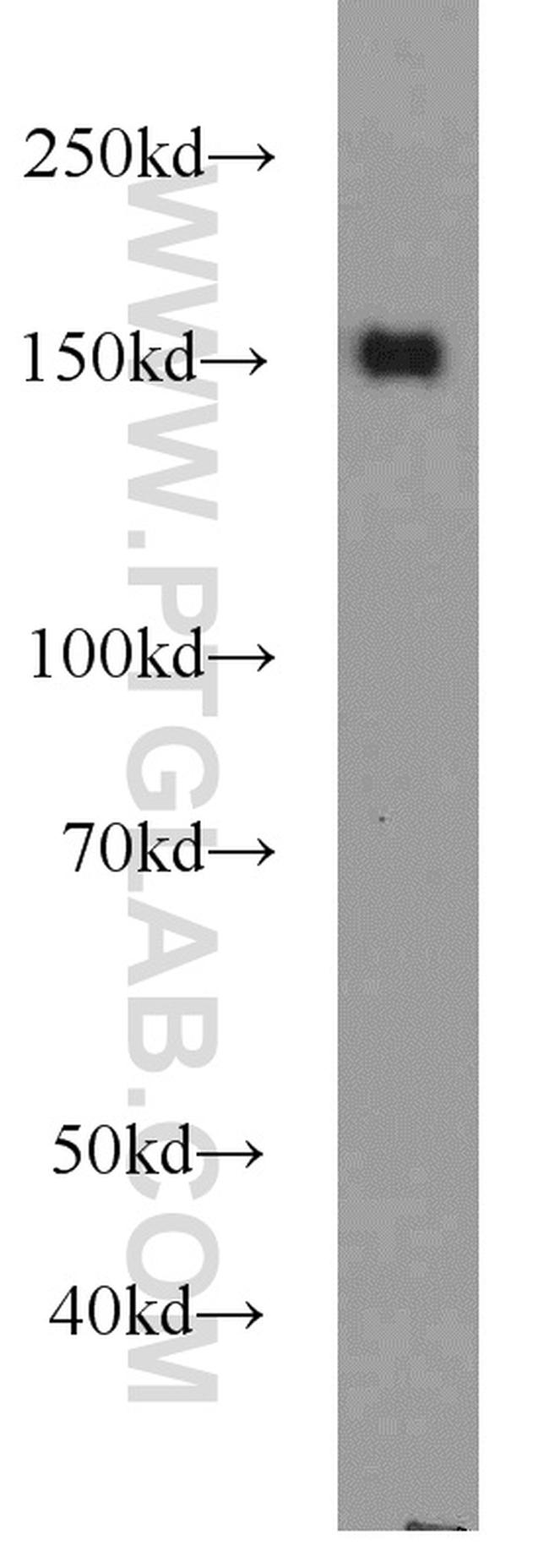 CHAF1A Antibody in Western Blot (WB)