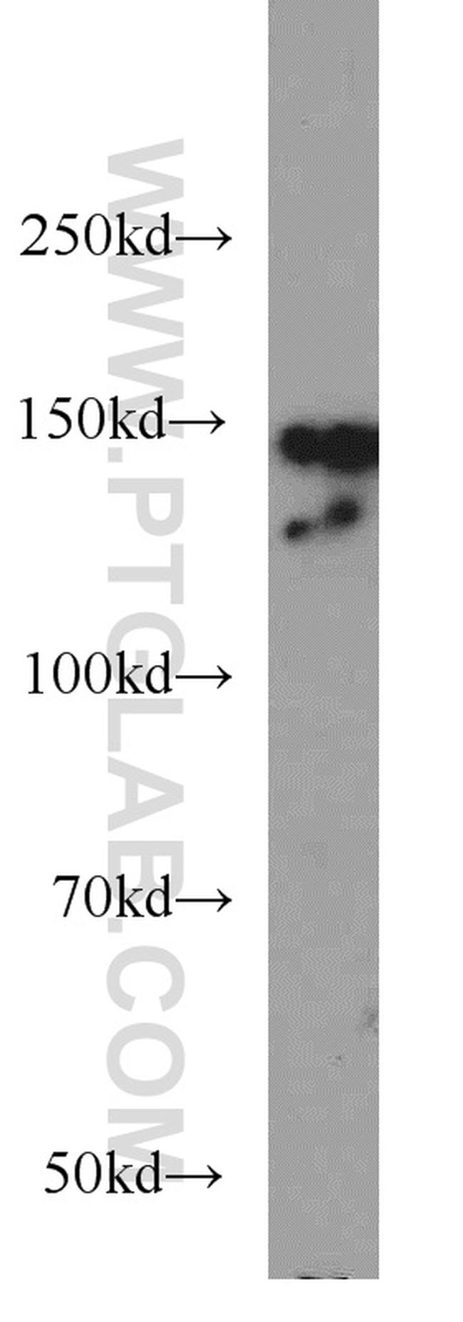 CHAF1A Antibody in Western Blot (WB)