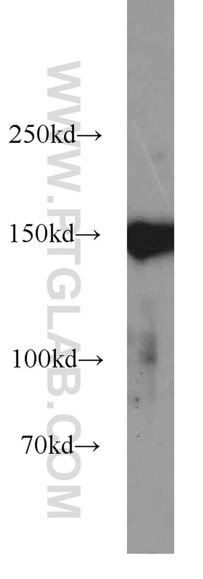 CHAF1A Antibody in Western Blot (WB)