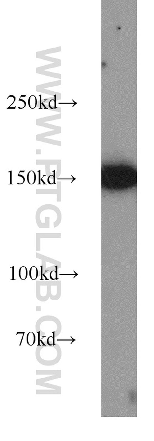 CHAF1A Antibody in Western Blot (WB)