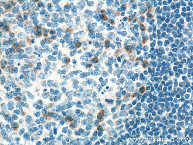 CXCL8/IL-8 Antibody in Immunohistochemistry (Paraffin) (IHC (P))