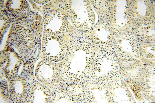 METAP2 Antibody in Immunohistochemistry (Paraffin) (IHC (P))