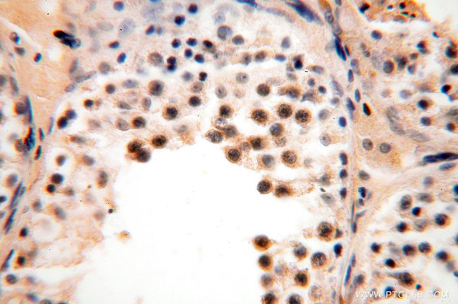 METAP2 Antibody in Immunohistochemistry (Paraffin) (IHC (P))