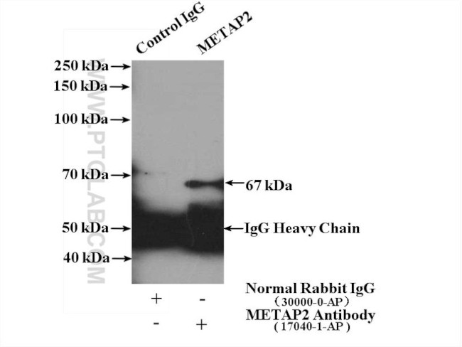 METAP2 Antibody in Immunoprecipitation (IP)