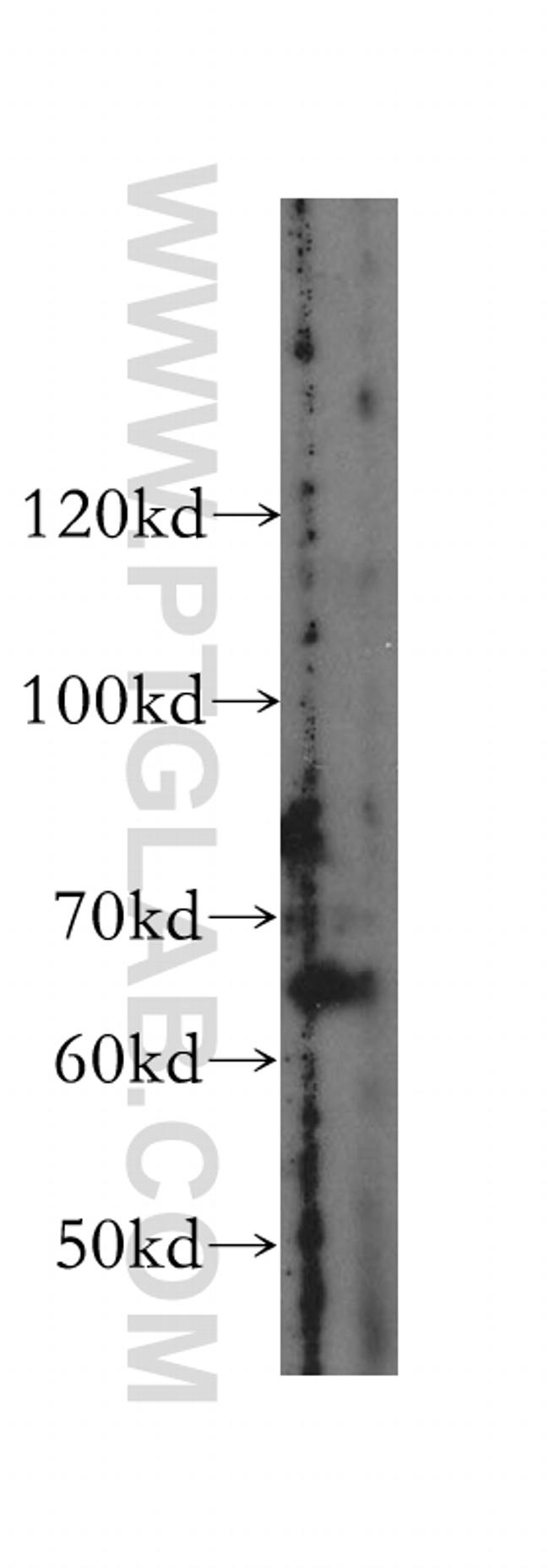 METAP2 Antibody in Western Blot (WB)