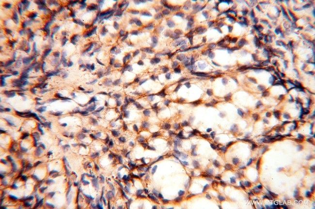 MRPS11 Antibody in Immunohistochemistry (Paraffin) (IHC (P))