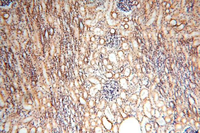 MRPS11 Antibody in Immunohistochemistry (Paraffin) (IHC (P))