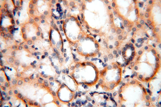 MRPS11 Antibody in Immunohistochemistry (Paraffin) (IHC (P))