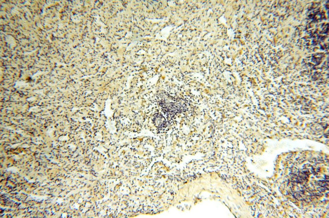 ROGDI Antibody in Immunohistochemistry (Paraffin) (IHC (P))