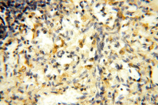 ROGDI Antibody in Immunohistochemistry (Paraffin) (IHC (P))