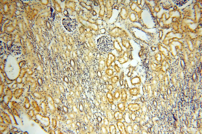 ROGDI Antibody in Immunohistochemistry (Paraffin) (IHC (P))