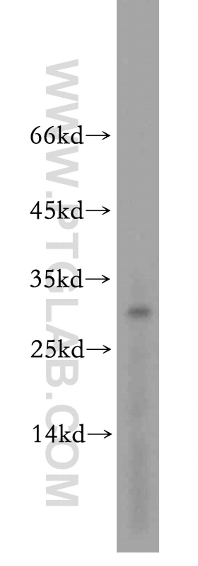 ROGDI Antibody in Western Blot (WB)