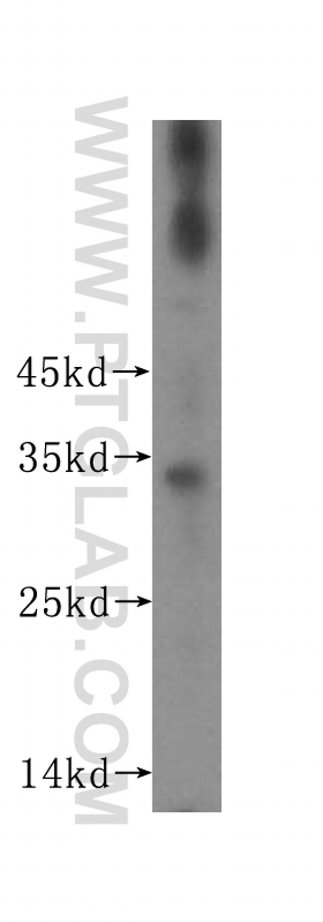 ROGDI Antibody in Western Blot (WB)