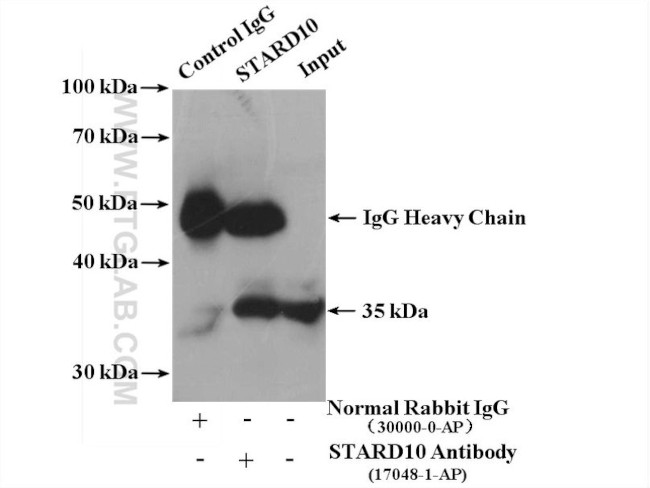 STARD10 Antibody in Immunoprecipitation (IP)