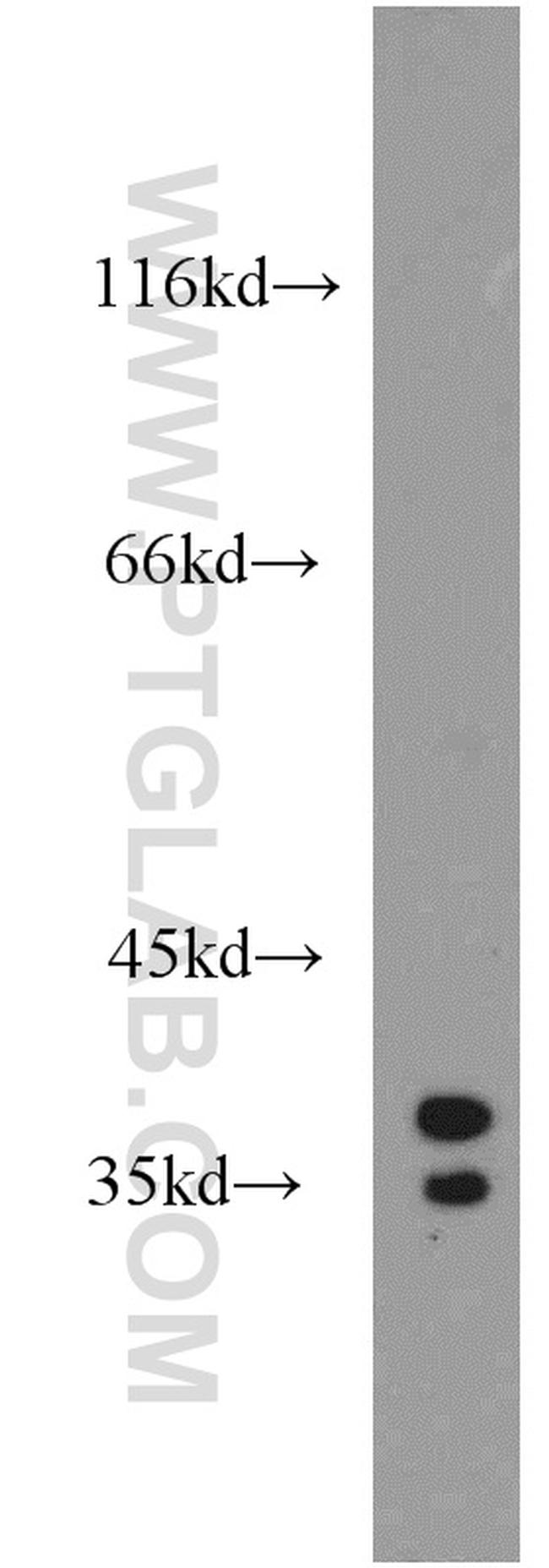 STARD10 Antibody in Western Blot (WB)