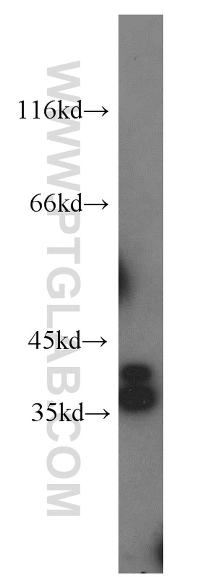 STARD10 Antibody in Western Blot (WB)