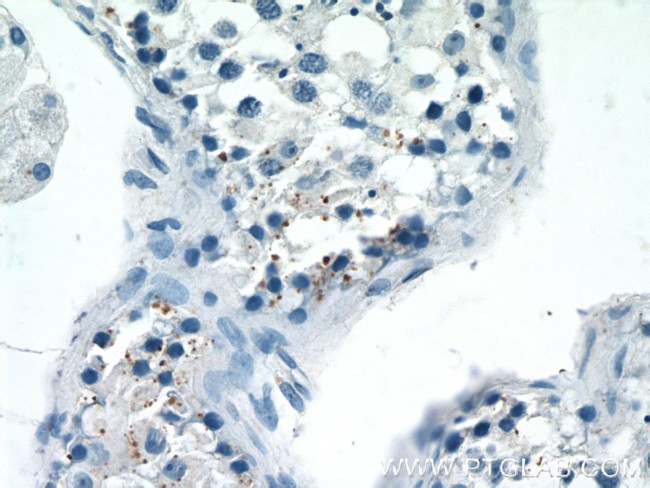 LATS1 Antibody in Immunohistochemistry (Paraffin) (IHC (P))