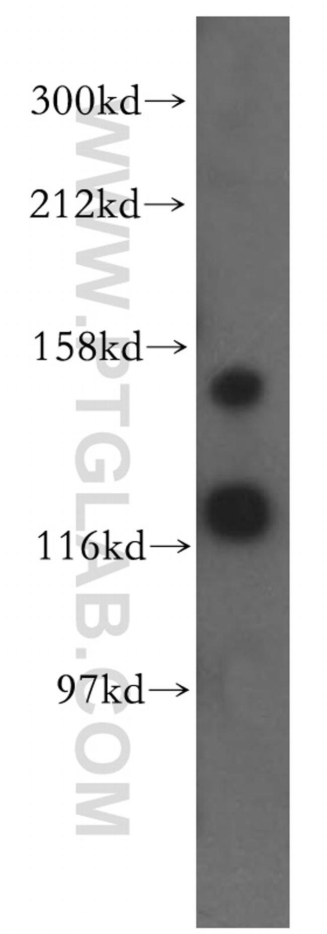 LATS1 Antibody in Western Blot (WB)