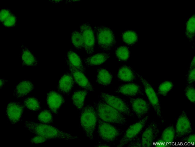 GTF2IRD1 Antibody in Immunocytochemistry (ICC/IF)