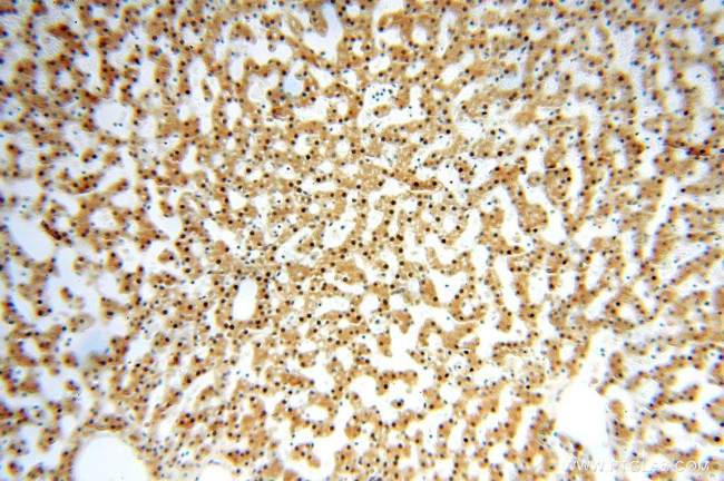 GTF2IRD1 Antibody in Immunohistochemistry (Paraffin) (IHC (P))