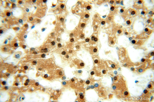 GTF2IRD1 Antibody in Immunohistochemistry (Paraffin) (IHC (P))