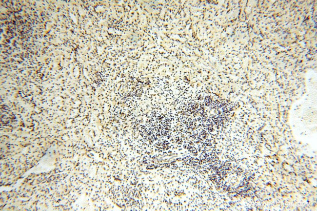 GTF2IRD1 Antibody in Immunohistochemistry (Paraffin) (IHC (P))