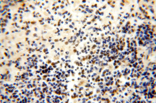 GTF2IRD1 Antibody in Immunohistochemistry (Paraffin) (IHC (P))