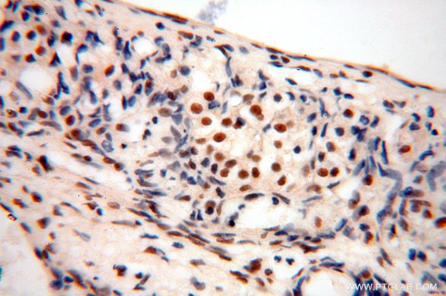 GTF2IRD1 Antibody in Immunohistochemistry (Paraffin) (IHC (P))